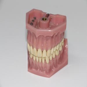치아-건강